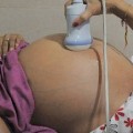 Une femme indienne subissant une échographie à Ahmedabad