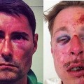 Sylvain et Wilfried, deux hommes agressés parce qu'homosexuels selon tous les médias..